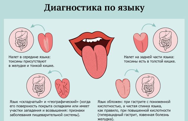О каких болезнях расскажет ваш язык? О каких болезнях расскажет ваш язык?