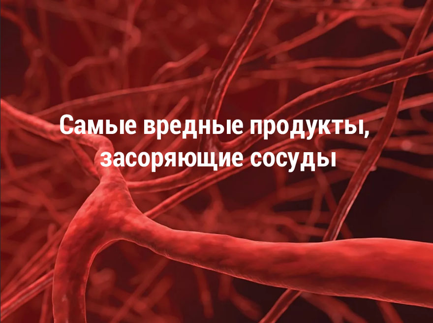 Самые вредные продукты, засоряющие сосуды