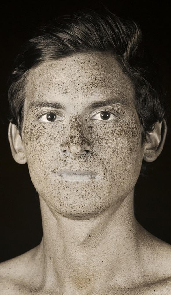 Портреты в ультрафиолете показывают вред солнечных лучей для кожи