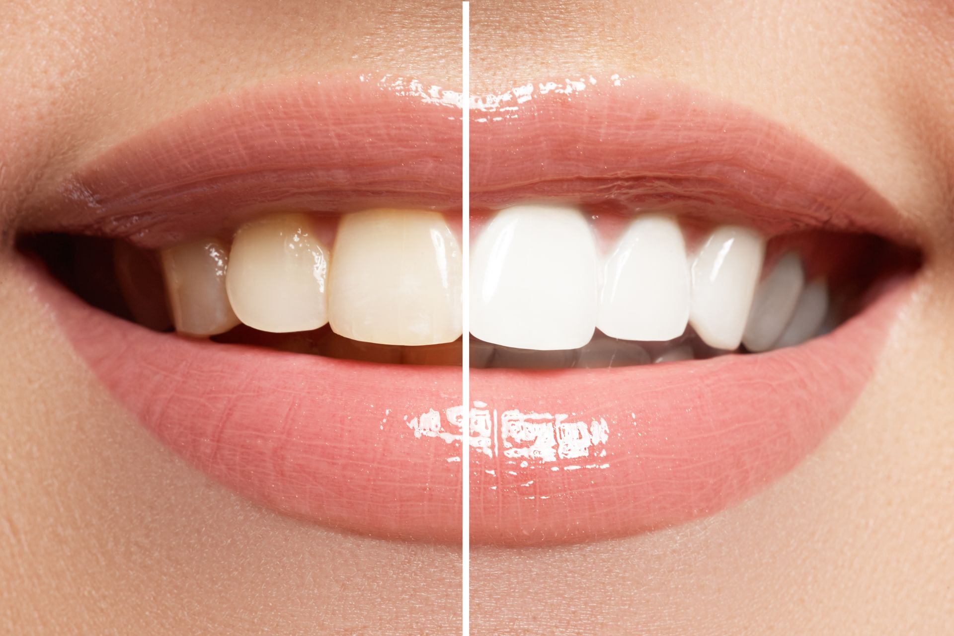 Какая еда влияет на белизну зубов?